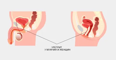 Лечение уретрита в клинике в Видном по доступной цене