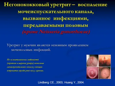 Диагностика и лечение негонококкового уретрита у мужчин - ppt download