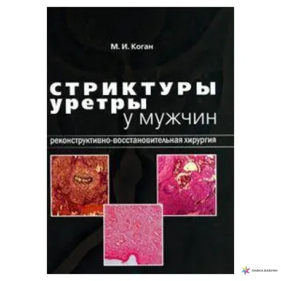 Уретрит: причины, симптомы, диагностика, лечение | Клиника «Наедине»