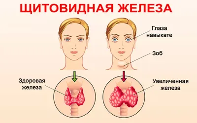 Щитовидная железа: ее функции и болезни. | В краю родном -- новости  Елецкого района