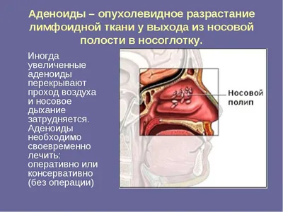 Зачем в СССР удаляли гланды и почему сегодня так не делают | Пикабу