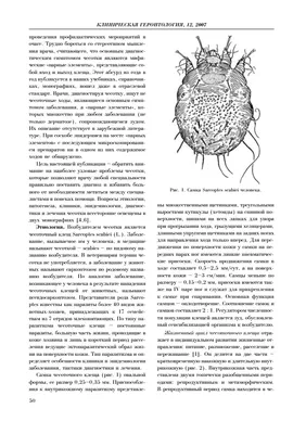 Чесотка у взрослых: симптомы, лечение, диагностика