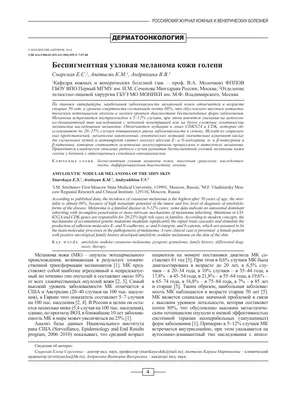 Диагностика и лечение меланомы кожи | ООО «Клинико-Диагностическое  общество» (КДО)