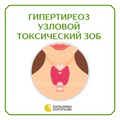 Узловой зоб лечение консультация в экспертной клинике ID-CLINIC  Санкт-Петербург