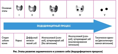 Лечение узлового зоба в Каменец-Подольском - медицинский центр Оксфорд  Медикал