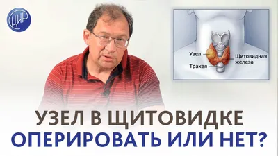 Что нужно знать о распространенных заболеваниях щитовидной железы | Молекула