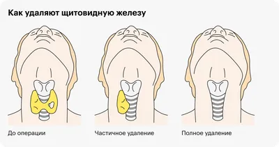 Допплерография ― допплеровское ультразвуковое исследование интенсивности  кровотока узлов щитовидной железы. Клиника Щитовидной Железы доктора А. В.  Ушакова ― официальный сайт.