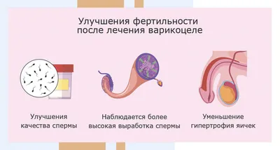 Операция Мармара при варикоцеле - особенности метода Мармара, показания к  операции и техника выполнения