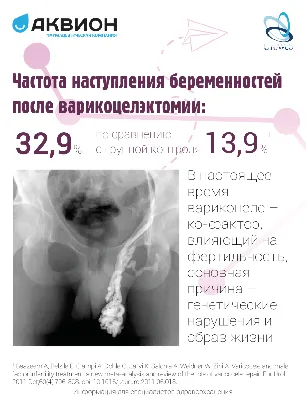 Варикоцеле у мужчин – что это такое? — Медицинский центр «Целитель»