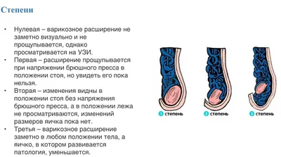 Гель Вариус от варикоцеле (id 45682386), купить в Казахстане, цена на  Satu.kz