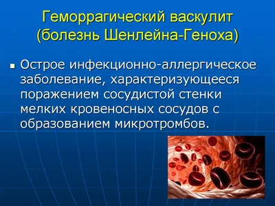 Васкулит: причины, виды, симптомы, диагностика и лечение васкулита в Москве  - сеть клиник «Ниармедик»