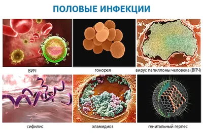 Стенд \"Венерические болезни\" купить недорого с доставкой по России