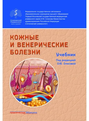 Венерические болезни «помолодели» » Усольская Городская Газета