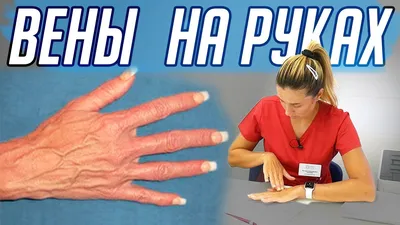 veins on the hand, aesthetics, вены на руке, эстетика. | Эстетика, Руки