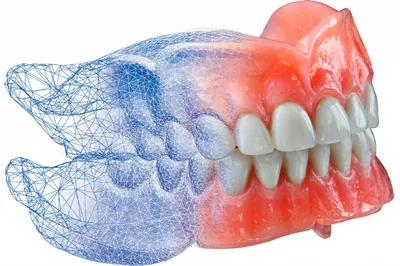 Обзор всех съёмных зубных протезов