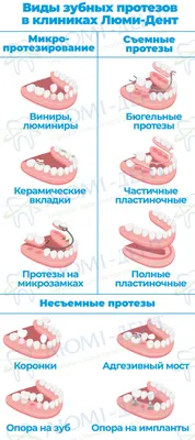 Верхний зубной протез: цена, виды протезов на верхнюю челюсть | НоваДент