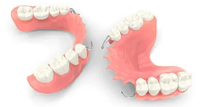 Зубные протезы нового поколения без нёба [цена в Москве]