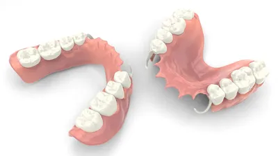 Верхний зубной протез: цена, виды протезов на верхнюю челюсть | НоваДент