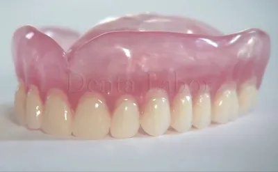 Съемный зубной протез на верхнюю челюсть купить в Denta-Labor | Полные съемные  протезы при полном отсутствии зубов на верхней челюсти цена