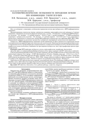 Как сегодня люди воспринимают ВИЧ-инфекцию?