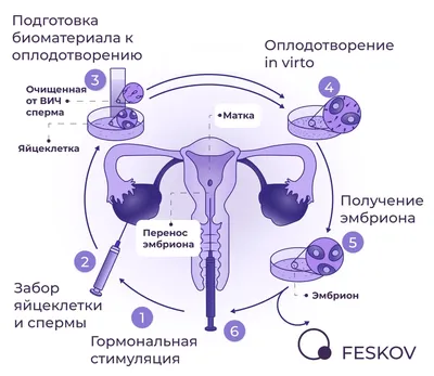 Инфекция ВИЧ