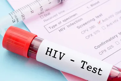 https://livehiv.ru/intervyu/semero-smelykh-v-ekaterinburge-pokazali-foto-lyudey-kotorye-ne-skryvayut-svoy-vich-status.html