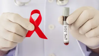 Методы диагностики ВИЧ-инфекции / СПИД - MedTour
