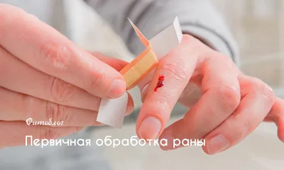 Столбняк он же tetanus — прививка как профилактика столбняка и симптомы  болезни / NV