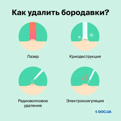 Удаление бородавок, удаление папиллом, удаление родинок и других  новообразований