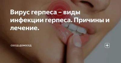 Виды герпеса на лице: в носу, на губах, подбородке и на глазу – симптомы и  как лечить герпес