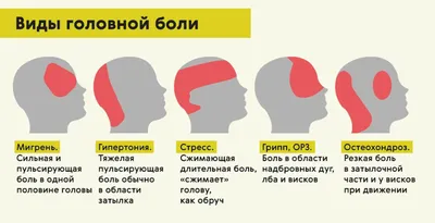 Головная боль и её виды — ГБУЗ Московской области \"Долгопрудненская  больница\"