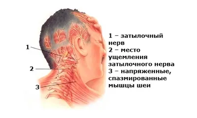 Виды головной боли. Типы, локализация и что означают боли в голове.