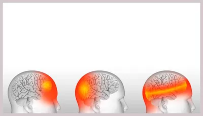 Головная боль: причины, диагностика, лечение - Клиника Лоритом