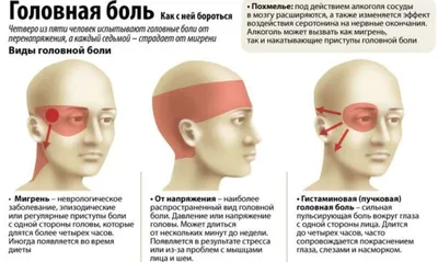 7 видов головной боли: чем отличаются и о чем говорят