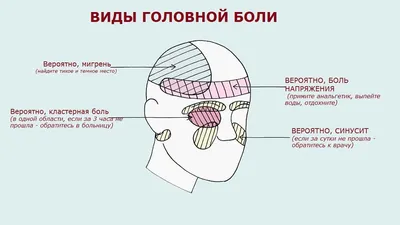 Виды головной боли. Типы, локализация и что означают боли в голове.