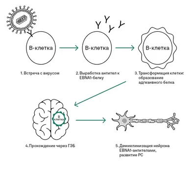 Вирус Эпштейна-Барра увеличивает риск развития рассеянного склероза -  pathology - mobile.Labmedica.com