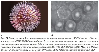 Чем отличаются вирусы от бактерий?