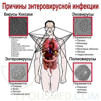 Энтеровирусы — Википедия