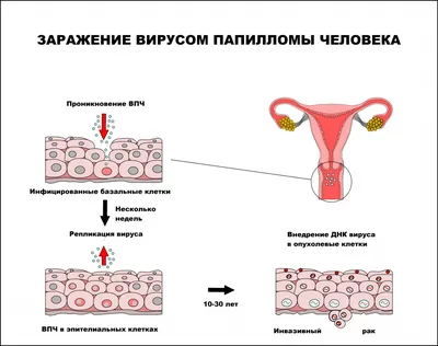 Вирус папилломы человека фото