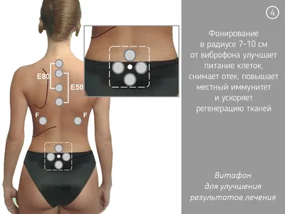 Отзыв о Аппарат виброакустического воздействия Витафон 5 | Лечение звуком :)