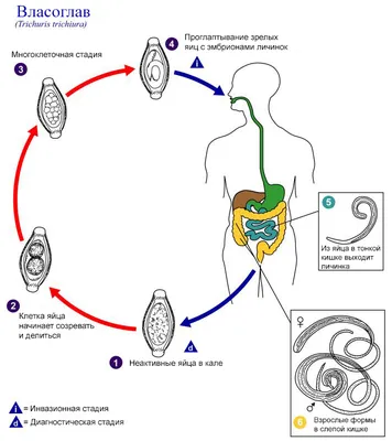 Власоглав (Trichuris trichiura). Трихоцефалёз