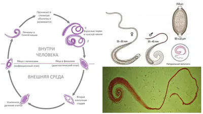 Власоглав — стоковые фотографии и другие картинки Pinworm - Pinworm,  Анализировать, Без людей - iStock