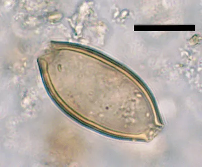 Власоглав — стоковые фотографии и другие картинки Pinworm - Pinworm, Без  людей, Болезнь - iStock