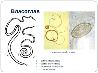 ВЛАСОГЛАВ, Trichocephalus trichiurus – геогельминт, возбудитель  трихоцефалеза