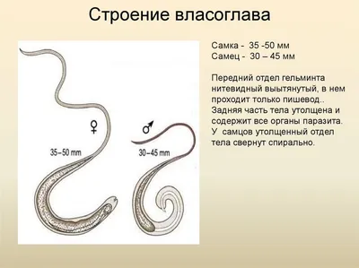 Власоглав Человеческий (Trichocephalus trichiurus) Морфология, Жизненный  Цикл, Симптомы, Диагностика - YouTube