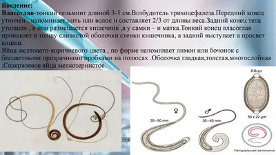 Trichuris Trichiura Trichocephalus Trichiuris Или Власоглав Является  Паразитическим Круглым Червем — стоковая векторная графика и другие  изображения на тему Паразитизм - iStock