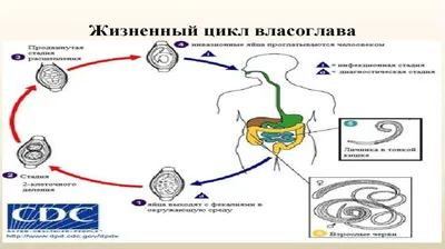 Яйцо Власоглав В Стуле, Анализируют С Помощью Микроскопа Фотография,  картинки, изображения и сток-фотография без роялти. Image 54719974