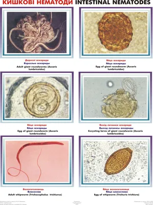 Среди всех глистов-паразитов,... - Педиатр Юлия Неизвесная | Facebook