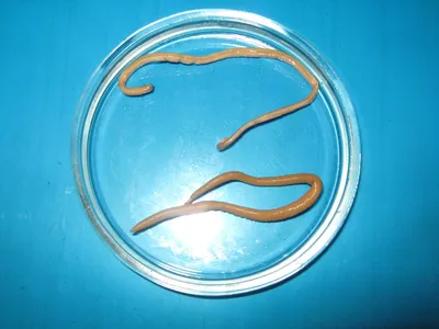 Власоглав (Trichuris trichiura)