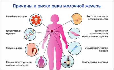 Рак молочной железы:Рак молочной железы: виды, признаки и прогноз после  лечения,Симптомы и первые признаки рака груди,Группа риска | doc.ua